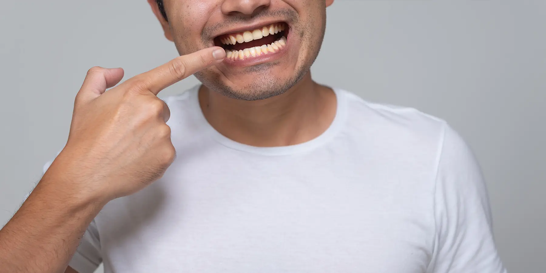 The Hidden Signs of Tongue Tie in Adults: What You Need to Know