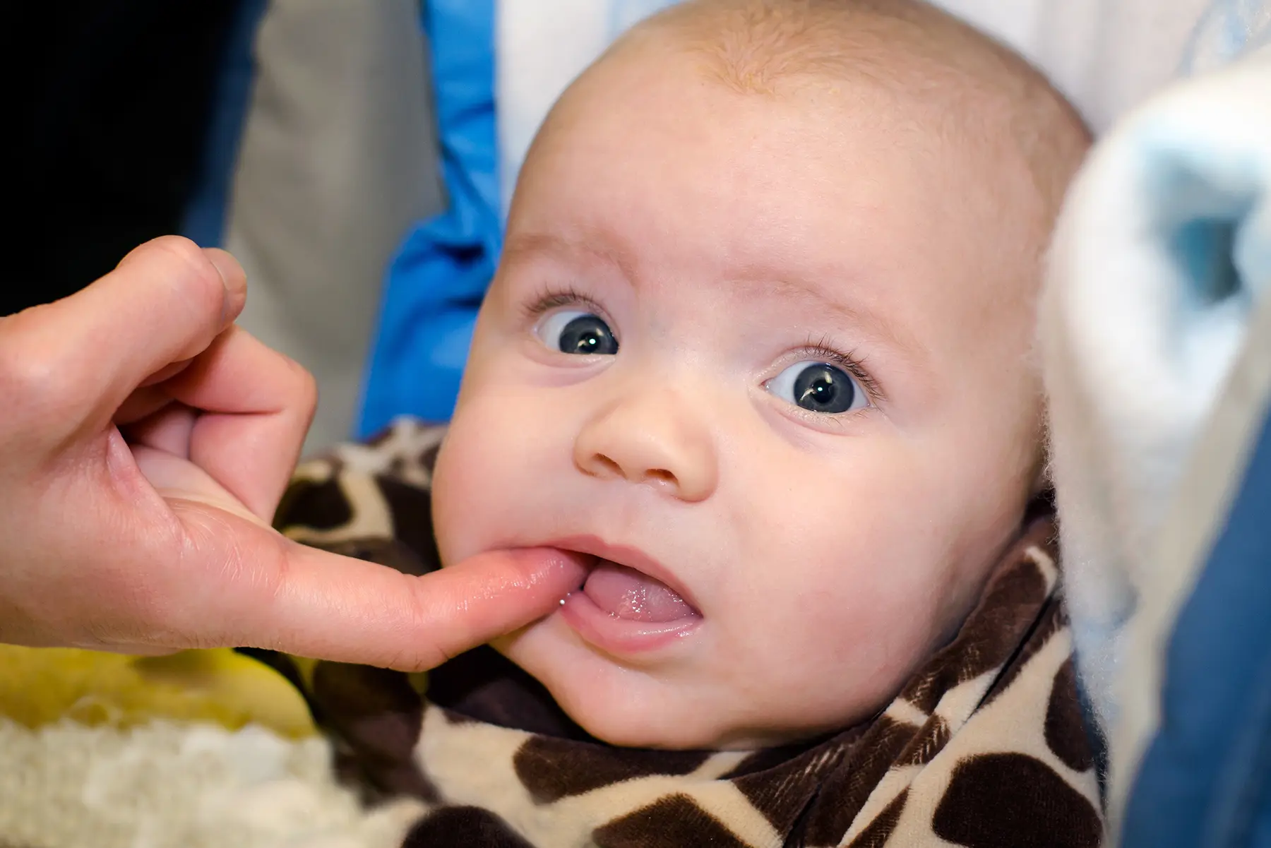 Signs of Infection After a Frenectomy: What to Watch For