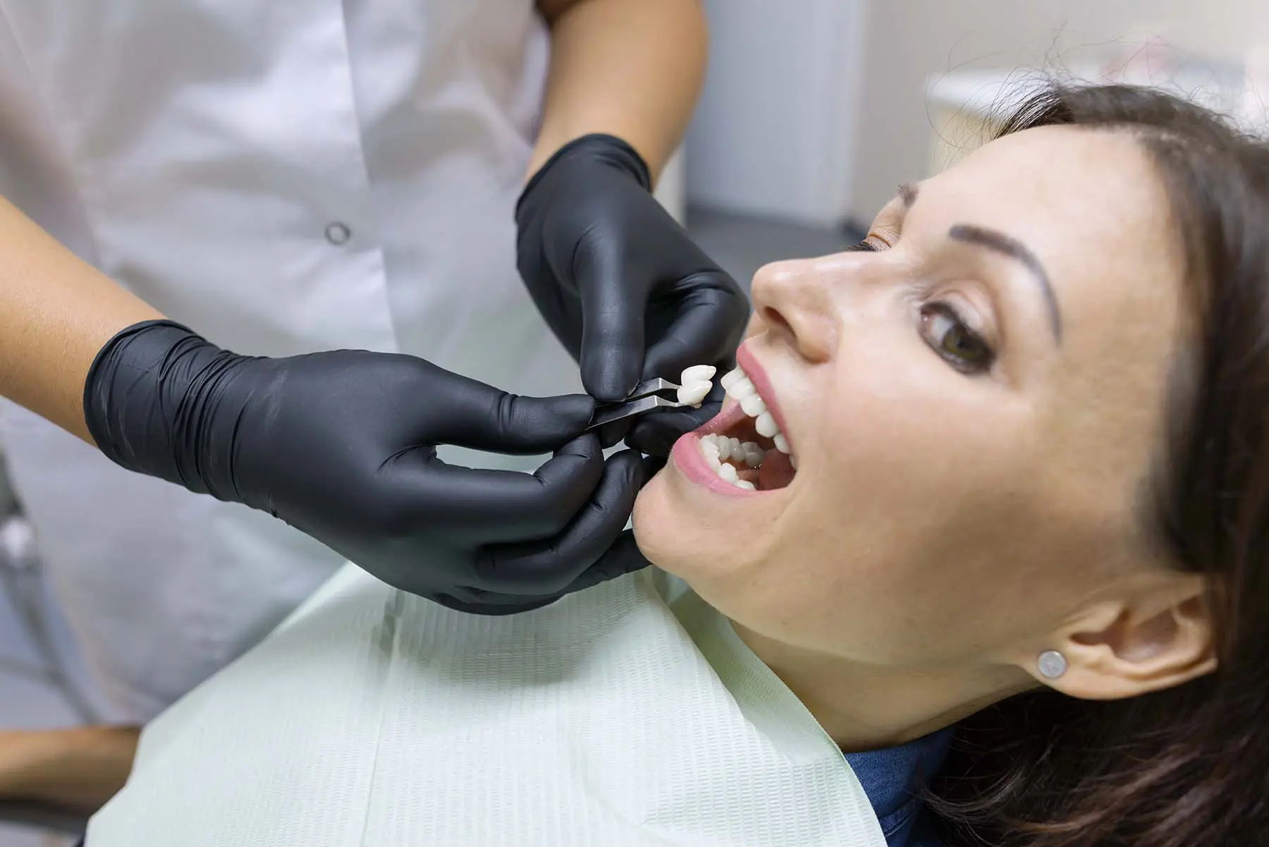 The Real Cost of Not Replacing a Missing Tooth