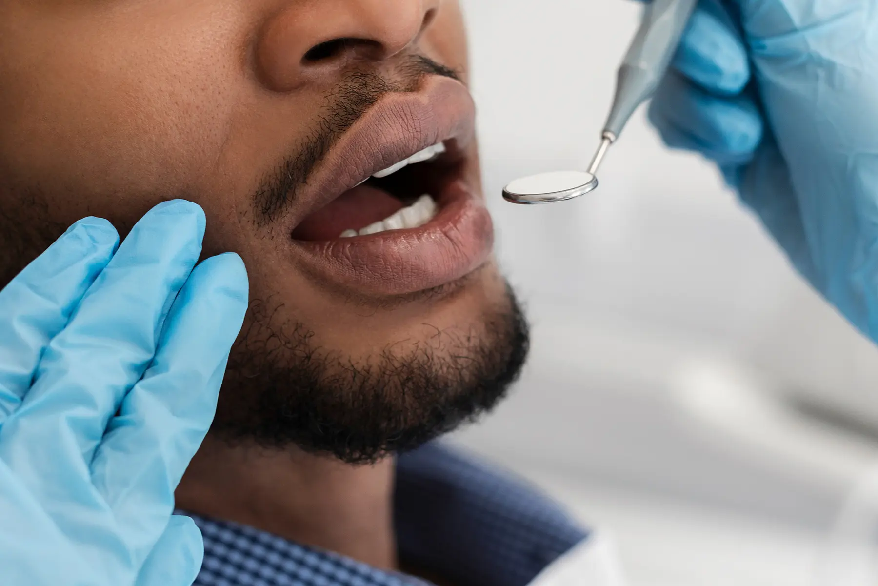 Can a Decayed Tooth Be Saved? What to Know Before Your Appointment