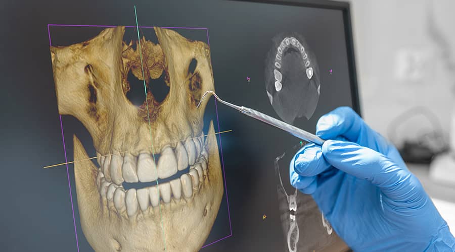 3D Dental Imaging