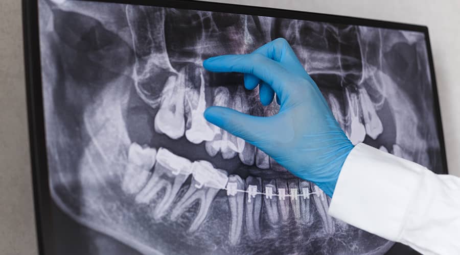 Oral Pathology and Diagnosis