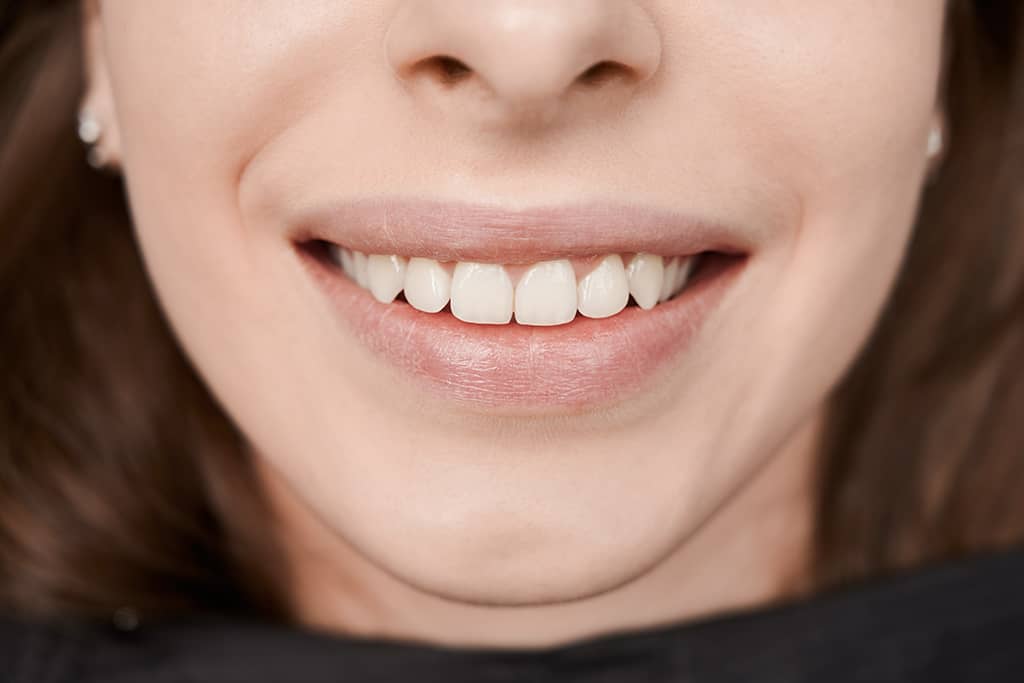 Dental Implant Parts: The Complete Guide to Your New Smile