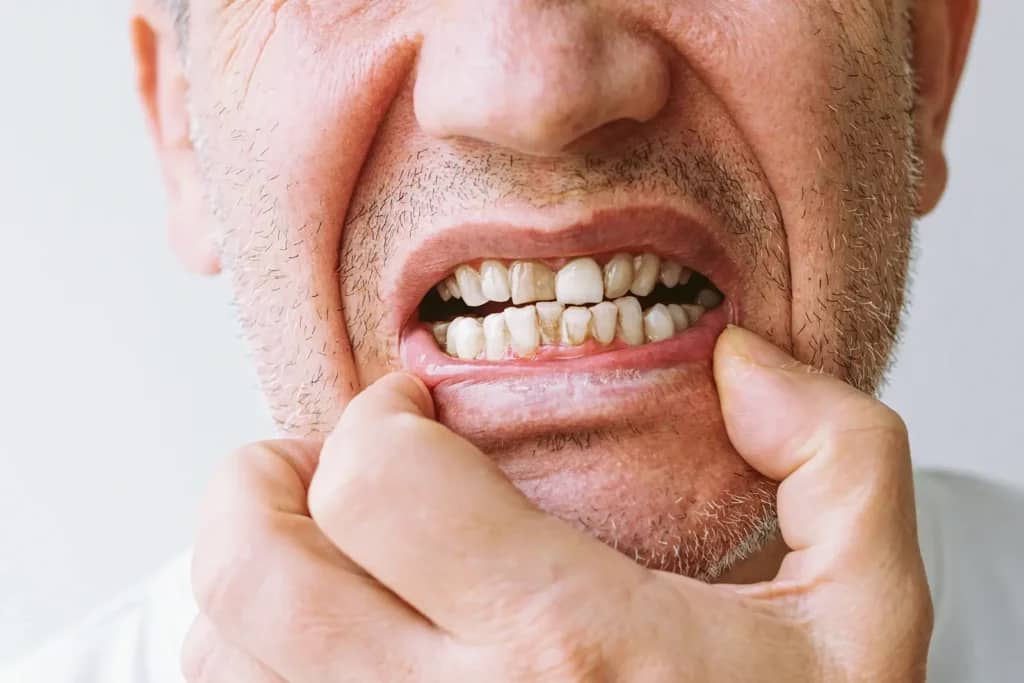 Dental Implants and Gum Disease: What You Need to Know