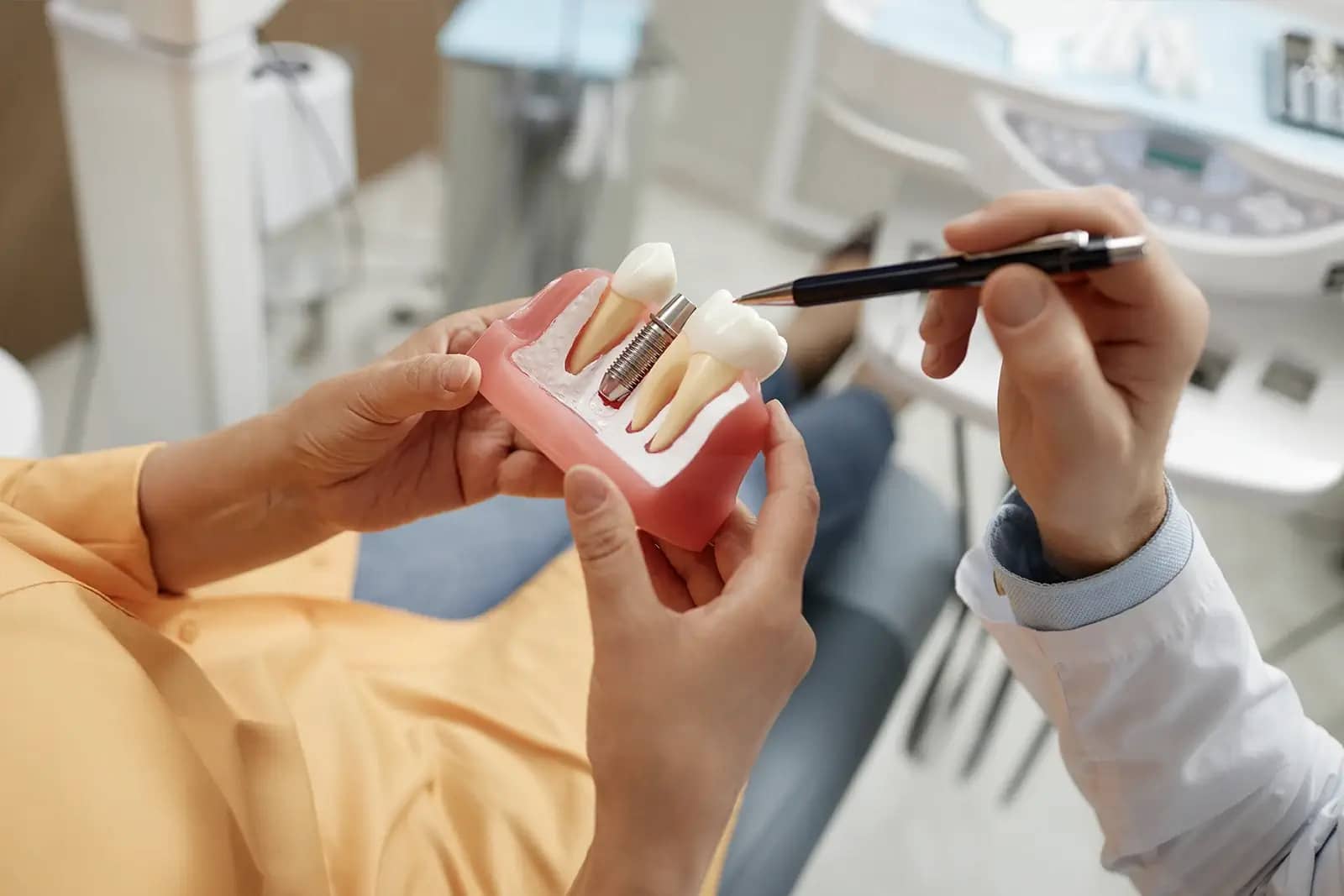 FAQs About Dental Implants